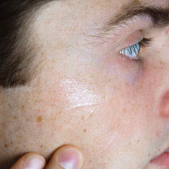 Clarifying Face Gel for Acne-prone Skin