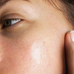 Microbiome Care for Acne-Prone Skin